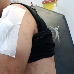 is gorusmesi icin cagrildi olumden dondu IcwDTcaT