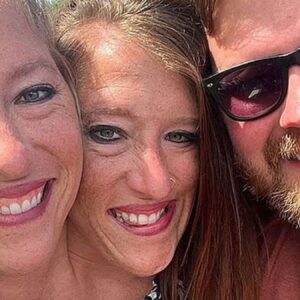 yapisik ikizlerden bebekli fotograf tip dunyasi sokta ls7EpL2M